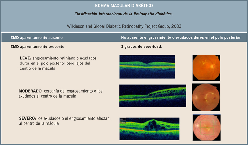 Articulo Oftalmologia 18468 articulo-oftalmologia-18468